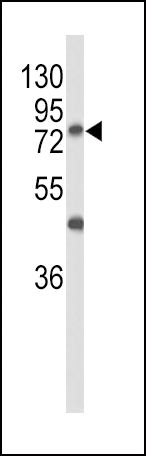 GALNT3 Antibody in Western Blot (WB)