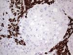 GLI1 Antibody in Immunohistochemistry (Paraffin) (IHC (P))