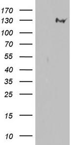 GLI1 Antibody in Western Blot (WB)