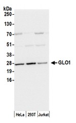 GLO1/Glyoxalase I Antibody in Western Blot (WB)