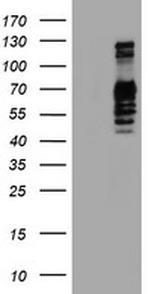 GOLM1 Antibody in Western Blot (WB)