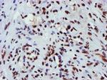 GSTT2 Antibody in Immunohistochemistry (Paraffin) (IHC (P))