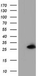 GSTT2 Antibody in Western Blot (WB)