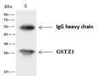 GSTZ1 Antibody in Immunoprecipitation (IP)