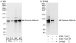 Gamma-Adducin Antibody in Western Blot (WB)