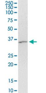 ARRB2 Antibody in Western Blot (WB)
