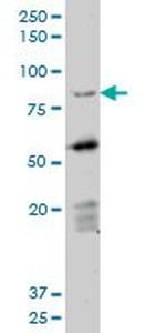 DAZ1 Antibody in Western Blot (WB)