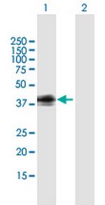 GPR1 Antibody in Western Blot (WB)