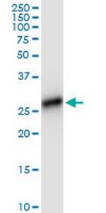 HLA-DRB4 Antibody in Western Blot (WB)