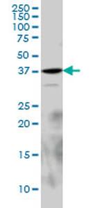 EPM2A Antibody in Western Blot (WB)