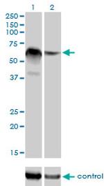 RBM5 Antibody in Western Blot (WB)