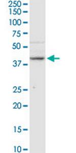 B3GNT3 Antibody in Western Blot (WB)