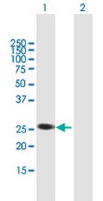 AGPAT1 Antibody in Western Blot (WB)