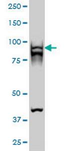 RAD54B Antibody in Western Blot (WB)