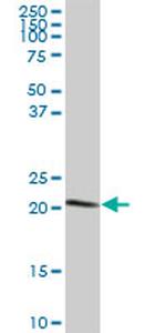 C7ORF44 Antibody in Western Blot (WB)
