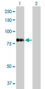 RASGRP4 Antibody in Western Blot (WB)
