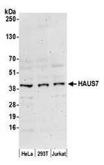 HAUS7 Antibody in Western Blot (WB)