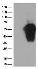 HAVCR2 Antibody in Western Blot (WB)