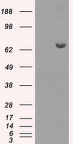 HDAC10 Antibody in Western Blot (WB)