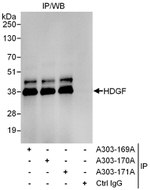 HDGF Antibody in Immunoprecipitation (IP)