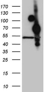 HOXA3 Antibody in Western Blot (WB)
