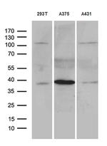 HOXD8 Antibody in Western Blot (WB)