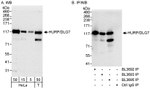 HURP/DLG7 Antibody in Western Blot (WB)
