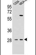 IL-12 p40 Antibody in Western Blot (WB)
