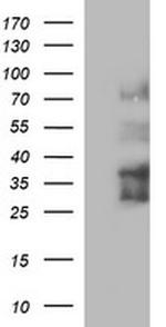 IL1A Antibody in Western Blot (WB)