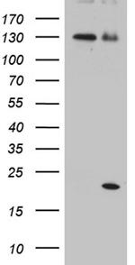 IL2 Antibody in Western Blot (WB)