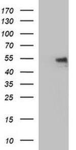 IL6R Antibody in Western Blot (WB)