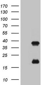 KLK3 Antibody in Western Blot (WB)