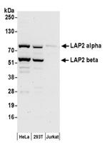 LAP2 alpha beta gamma/TMPO Antibody in Western Blot (WB)