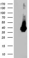 LDLRAP1 Antibody in Western Blot (WB)