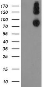 LEPRE1 Antibody in Western Blot (WB)