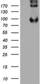 LEPRE1 Antibody in Western Blot (WB)
