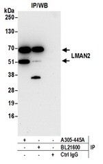 LMAN2 Antibody in Immunoprecipitation (IP)