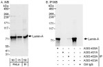 Lamin-A Antibody in Western Blot (WB)