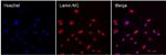 Lamin A/C Antibody in Immunocytochemistry (ICC/IF)
