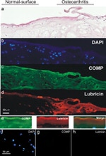 Lubricin Antibody in Immunohistochemistry (IHC)