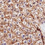 ABCA1 Antibody in Immunohistochemistry (Paraffin) (IHC (P))