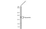 P-Glycoprotein Antibody in Western Blot (WB)
