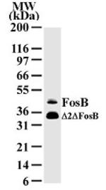 FosB Antibody in Western Blot (WB)