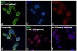 Amyloid Precursor Protein Antibody in Immunocytochemistry (ICC/IF)