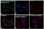 Estrogen Receptor alpha Antibody in Immunocytochemistry (ICC/IF)