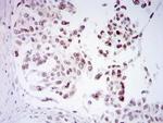 Fibrillarin Antibody in Immunohistochemistry (Paraffin) (IHC (P))
