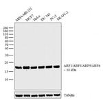 ARF1/ARF3/ARF5/ARF6 Antibody in Western Blot (WB)