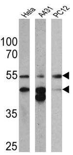 Cytokeratin Pan Antibody in Western Blot (WB)