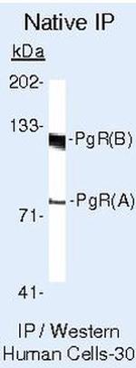 Progesterone Receptor Antibody in Immunoprecipitation (IP)