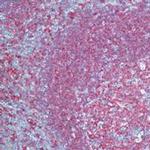 CD20 Antibody in Immunohistochemistry (Paraffin) (IHC (P))